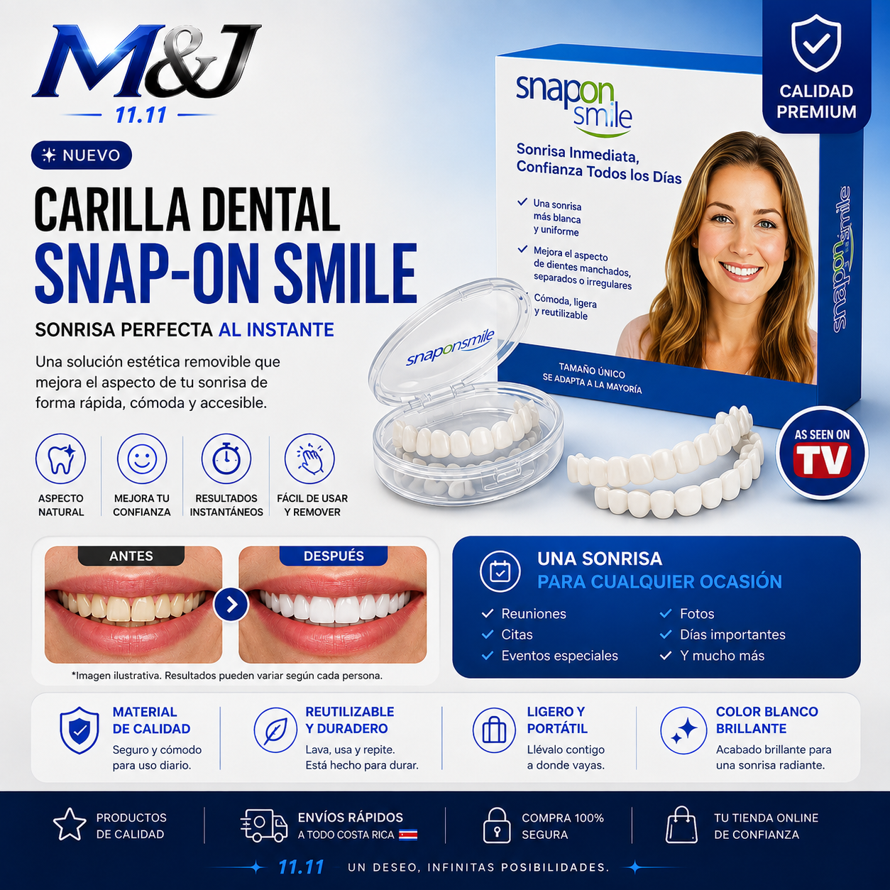 Carillas dentales | Snapon Smile